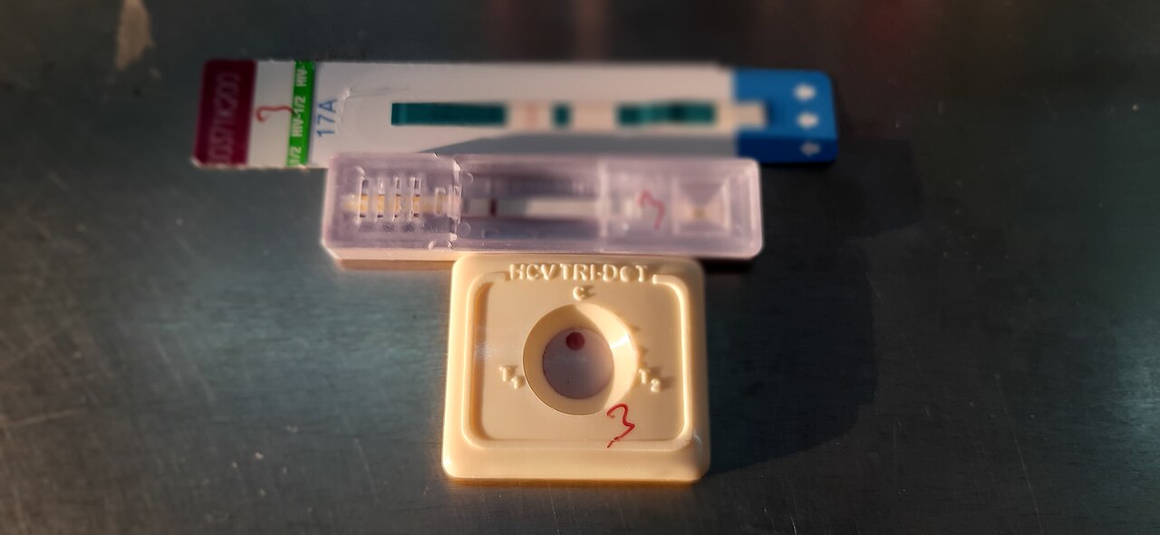 Des dispositifs de tests rapides VIH et hépatites sont posés côte à côte.